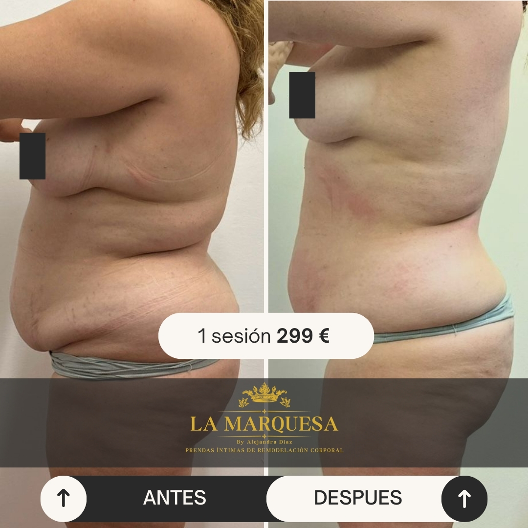 Copia de Beige Minimalist Skincare Before and After Instagram Post